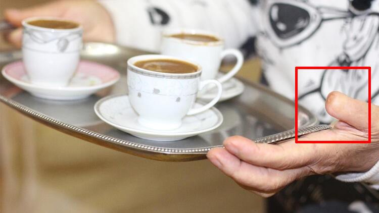 Ünlü fast food zincirinin açılışına gitmişti! Kopan parmağının cezası belli oldu...